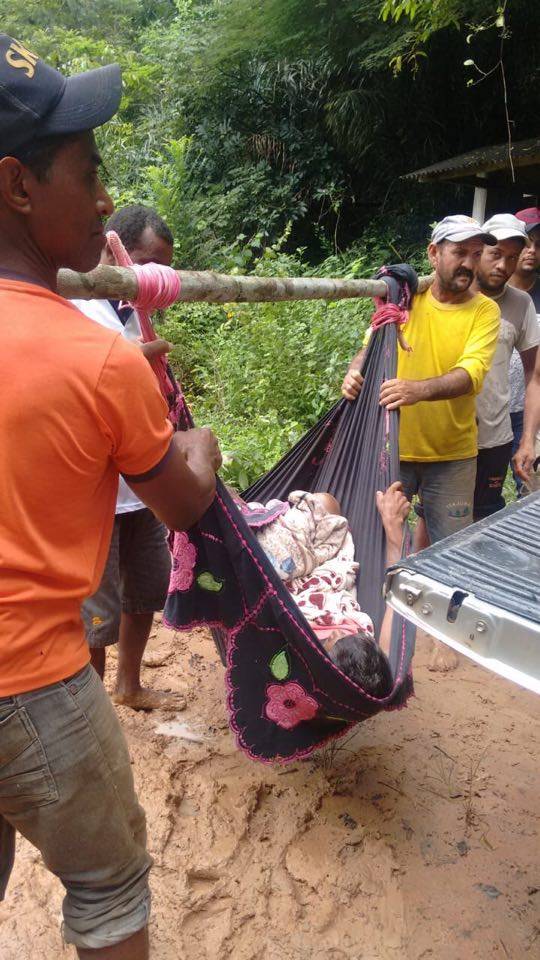 Homem é transportado em rede para hospital em Bom Jesus das Selvas (MA)