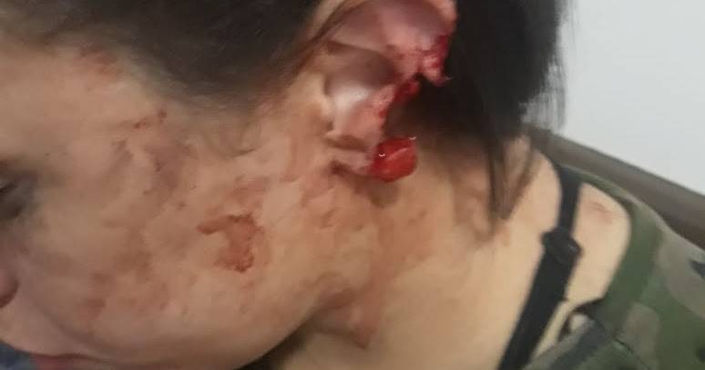 Homem arranca orelha da esposa com mordida e vai preso em Imperatriz (MA)
