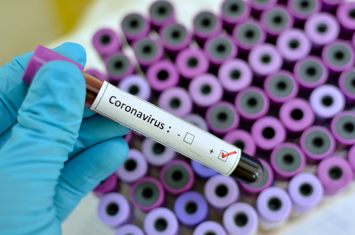Em menos de 24h, Maranhão dobra número de casos de coronavírus e vai para 52