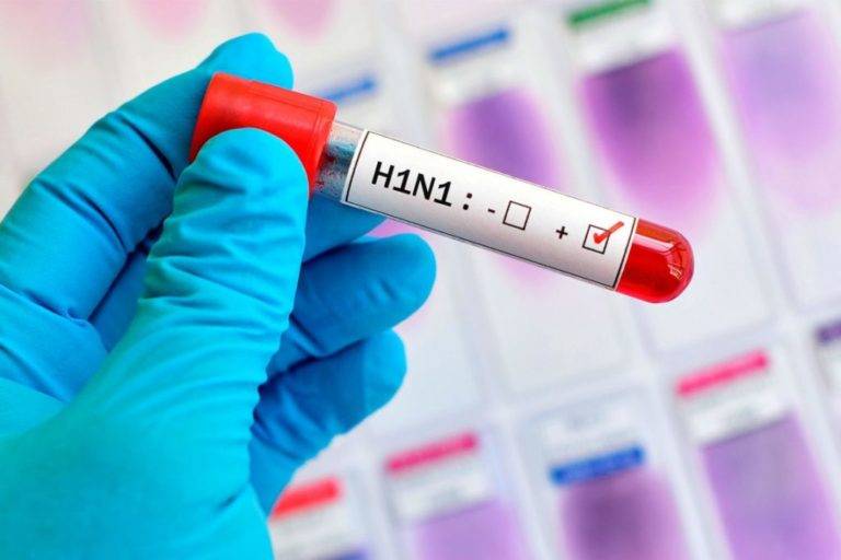 Secretaria de Saúde confirma 15 casos de H1N1 no Maranhão