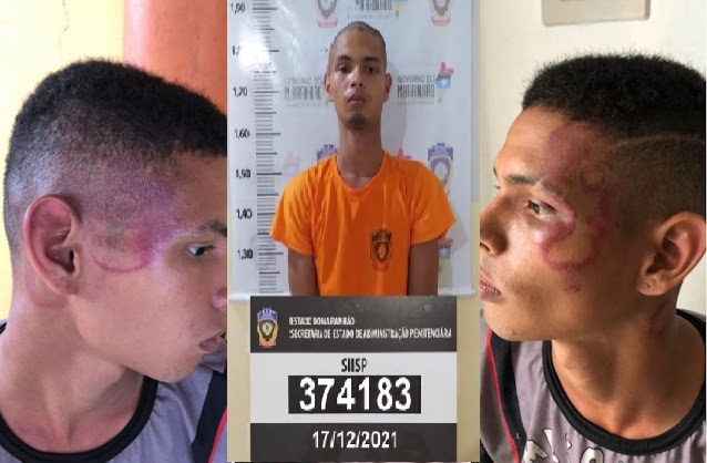 Jovem que diz ser trabalhador e ter apanhado de PM possui diversas passagens pela polícia no MA