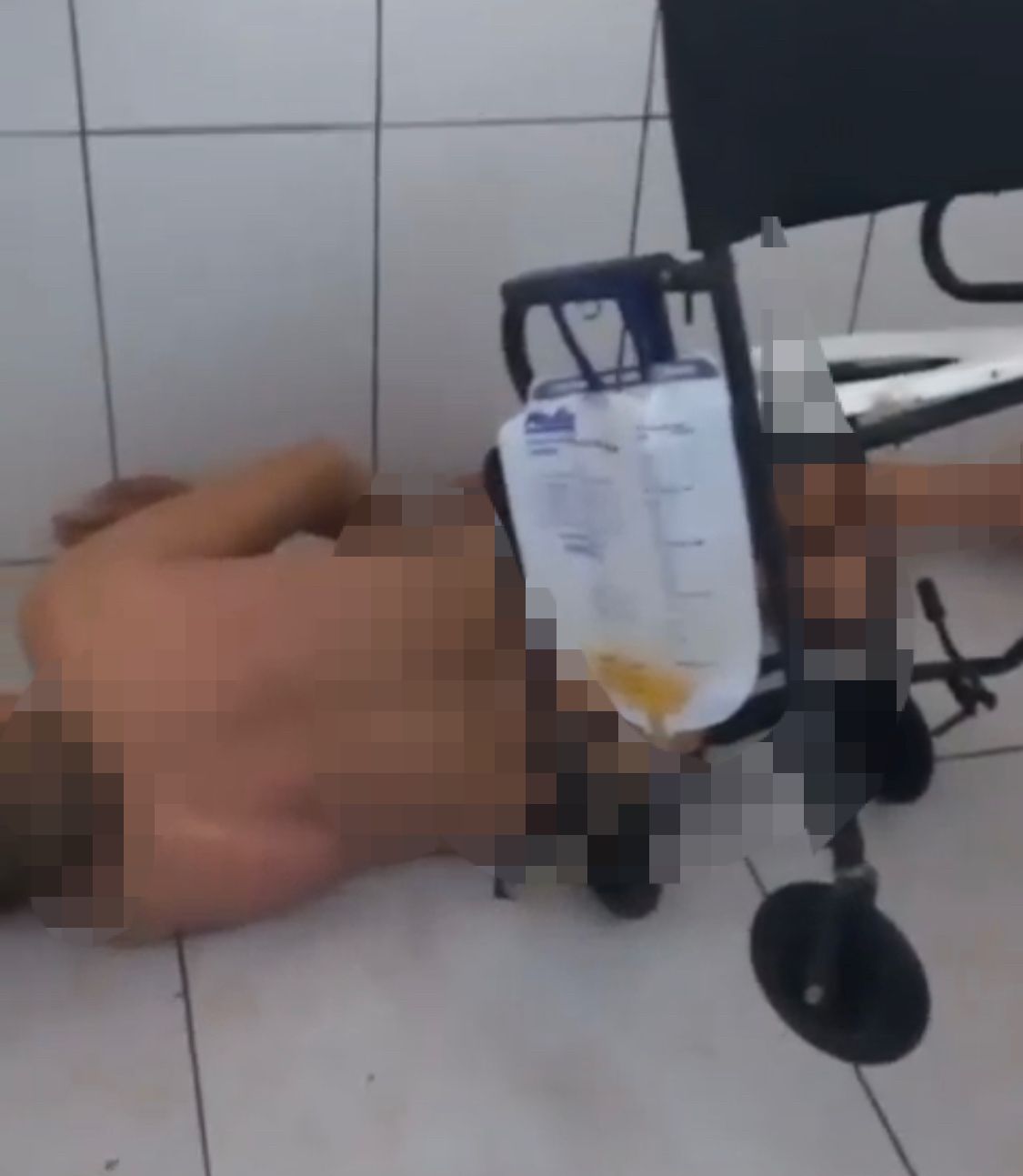 Vídeo mostra paciente com sonda agonizando sem roupa no chão de banheiro do hospital de Arame