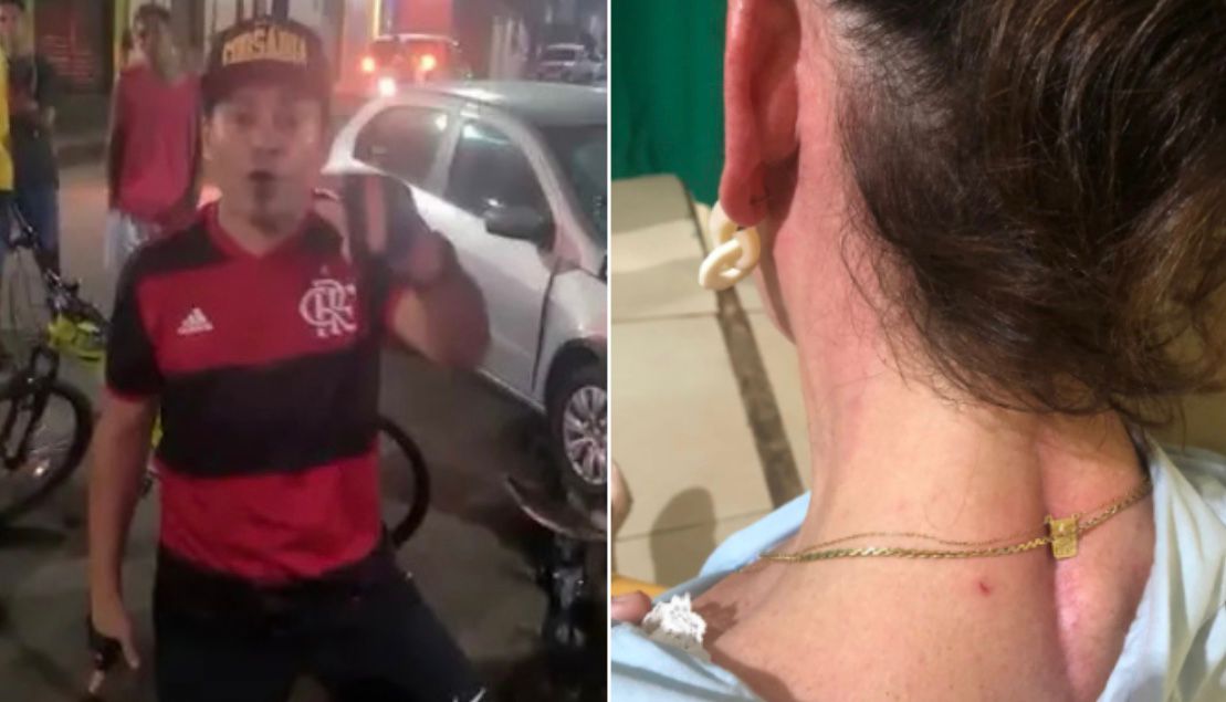 Advogada é agredida por policial civil durante discussão em Pinheiro no Maranhão