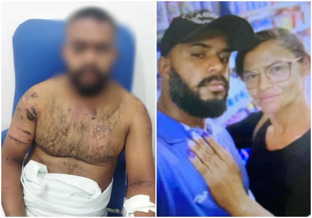 Mulher enciumada joga ácido no marido em Grajaú no Maranhão