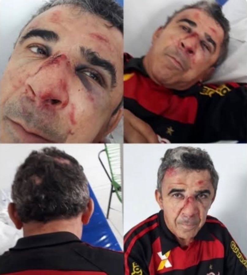 Homem com necessidades especiais é agredido brutalmente em Estreito